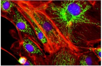 Digitální zobrazovací systém CELENA® S – nový standard pro kvalitní buněčné zobrazování