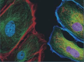 Kvalitní laboratorní plasty pro tkáňové kultury za výjimečné ceny 