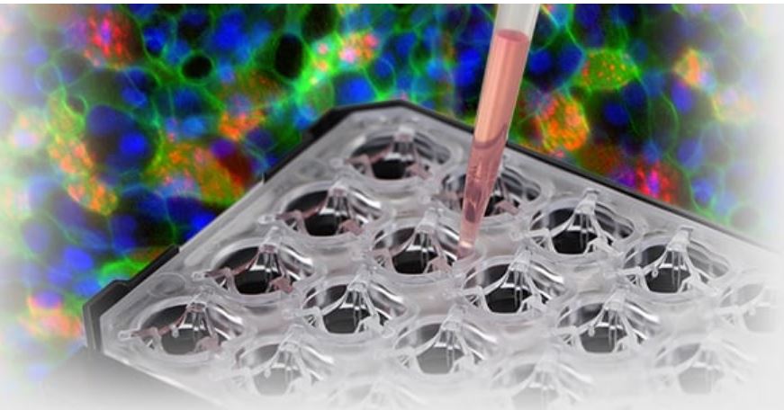 Zásobte se na zimu – ušetřete až 40 %! 