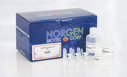 NORGEN  izolace exosomu v praxi